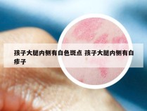 孩子大腿内侧有白色斑点 孩子大腿内侧有白疹子