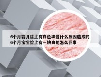 6个月婴儿脸上有白色块是什么原因造成的 6个月宝宝脸上有一块白的怎么回事