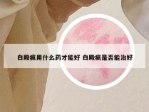 白殿疯用什么药才能好 白殿疯是否能治好