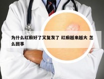 为什么红癣好了又复发了 红癣越来越大 怎么回事