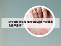 uvb银屑病复发 银屑病uvb光疗后复发会更严重吗?