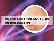 丙酸氯倍他索擦剂治疗银屑病多久见效 丙酸氯倍他索搽剂是激素药吗