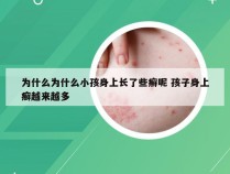 为什么为什么小孩身上长了些癣呢 孩子身上癣越来越多