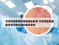 寻常型银屑病有哪些临床表现 寻常型银屑病最具有诊断价值的临床表现