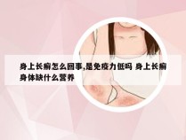 身上长癣怎么回事,是免疫力低吗 身上长癣身体缺什么营养