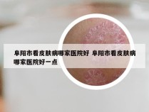 阜阳市看皮肤病哪家医院好 阜阳市看皮肤病哪家医院好一点