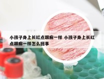 小孩子身上长红点跟癣一样 小孩子身上长红点跟癣一样怎么回事