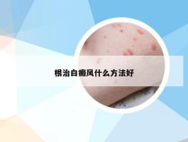 根治白癜风什么方法好