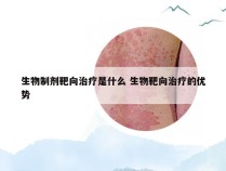 生物制剂靶向治疗是什么 生物靶向治疗的优势