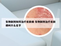 生物制剂如何治疗皮肤病 生物制剂治疗皮肤病叫什么名字