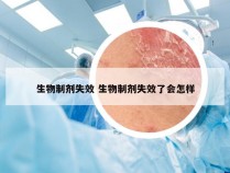 生物制剂失效 生物制剂失效了会怎样