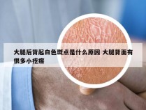 大腿后背起白色斑点是什么原因 大腿背面有很多小疙瘩