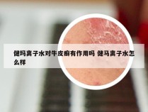 健玛离子水对牛皮癣有作用吗 健马离子水怎么样