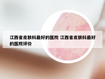 江西省皮肤科最好的医院 江西省皮肤科最好的医院评价