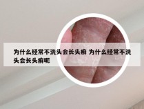 为什么经常不洗头会长头癣 为什么经常不洗头会长头癣呢