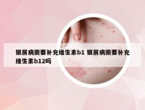 银屑病需要补充维生素b1 银屑病需要补充维生素b12吗