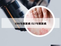 ERK与银屑病 il17与银屑病