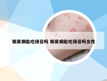 银屑病能吃绿豆吗 银屑病能吃绿豆吗女性