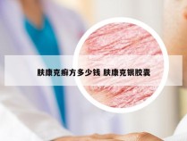 肤康克癣方多少钱 肤康克银胶囊