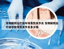 生物制剂治疗幼年特发性关节炎 生物制剂治疗幼年特发性关节炎多少钱