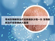 常州生物制剂治疗皮肤病多少钱一针 生物制剂治疗皮肤病纳入医保