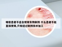 哪些患者不适合使用生物制剂 什么患者不能直接使用,只有经过制剂技术加工