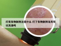 打完生物制剂注意什么 打了生物制剂当天可以洗澡吗