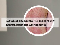 治疗皮肤病用生物制剂有什么副作用 治疗皮肤病用生物制剂有什么副作用和危害