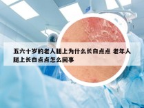 五六十岁的老人腿上为什么长白点点 老年人腿上长白点点怎么回事