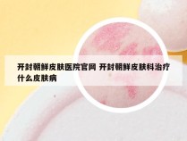 开封朝鲜皮肤医院官网 开封朝鲜皮肤科治疗什么皮肤病