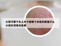 小孩子那个头上长个癣那个白色的癣是什么 小孩头顶有白色癣