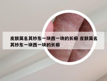 皮肤莫名其妙东一块西一块的长癣 皮肤莫名其妙东一块西一块的长癣