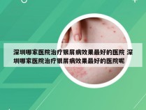 深圳哪家医院治疗银屑病效果最好的医院 深圳哪家医院治疗银屑病效果最好的医院呢