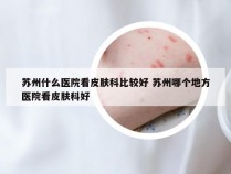 苏州什么医院看皮肤科比较好 苏州哪个地方医院看皮肤科好