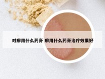 对癣用什么药膏 癣用什么药膏治疗效果好