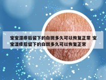 宝宝湿疹后留下的白斑多久可以恢复正常 宝宝湿疹后留下的白斑多久可以恢复正常