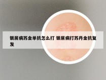 银屑病苏金单抗怎么打 银屑病打苏丹金抗复发