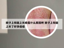 膀子上和腿上长癣是什么原因啊 膀子上和腿上长了好多痘痘