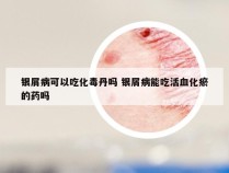 银屑病可以吃化毒丹吗 银屑病能吃活血化瘀的药吗