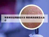 银屑病消退期最佳方法 银屑病消退期怎么治疗