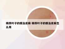 杨铁叶子的根治皮癣 杨铁叶子的根治皮癣怎么用