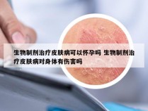 生物制剂治疗皮肤病可以怀孕吗 生物制剂治疗皮肤病对身体有伤害吗