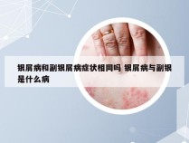 银屑病和副银屑病症状相同吗 银屑病与副银是什么病