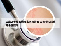 云南省看皮肤病哪家医院最好 云南看皮肤病哪个医院好