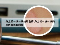 身上长一块一块的红色癣 身上长一块一块的红色癣怎么回事