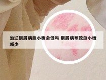 治辽银屑病血小板会低吗 银屑病导致血小板减少