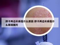 脖子两边长癣是什么原因 脖子两边长癣是什么原因图片