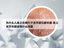 为什么人身上长癣六个关节部位都长癣 身上关节长癣说明什么问题