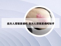 南方人得银屑病吗 南方人得银屑病吗知乎