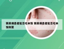 银屑病患者能否吃米饭 银屑病患者能否吃米饭和菜